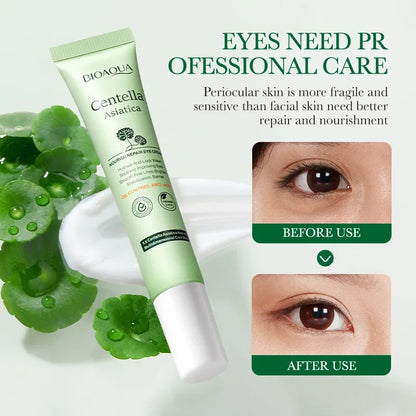 Centella Asiatica eye cream for hydration, wrinkle reduction, and under-eye care